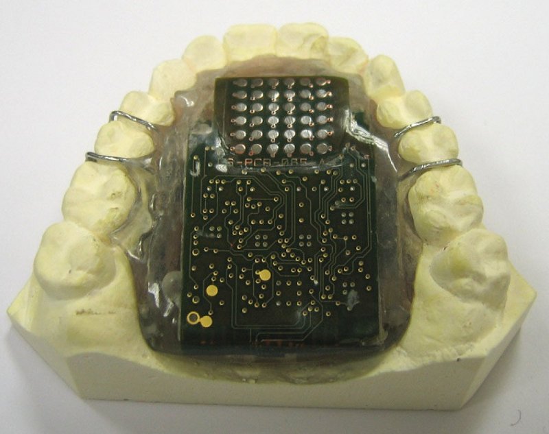 Surgical Electrotactile Tongue Interface