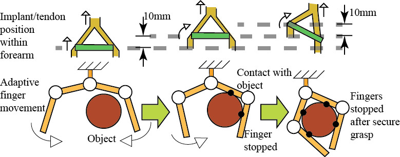 Implantable adaptive grasping mechanism