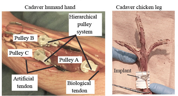 Implantable adaptive grasping mechanism